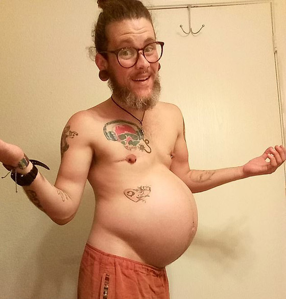 لأول مرة في العالم: رجل حامل يضع أول أطفاله! فيديو وصور صورة رقم 1