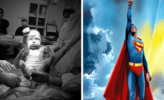 صور مذهلة: لحظة ولادة طفل رضيع يدخل للعالم على هيئة سوبرمان صورة رقم 2