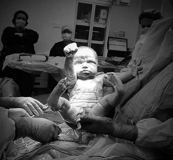 صور مذهلة: لحظة ولادة طفل رضيع يدخل للعالم على هيئة سوبرمان صورة رقم 1