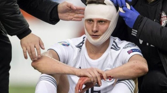 لاعب كرة قدم جورجي ينقذ حياة سويسري ابتلع لسانه في مباراة صورة رقم 3