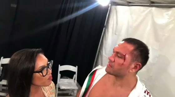 إيقاف كوبرا الوزن الثقيل في الملاكمة بعد تقبيله مراسلة صحفية.. فيديو وصور صورة رقم 4