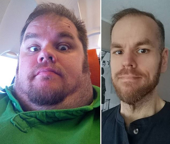 رجل يخسر 215 كيلوغراما ويصبح أكبر خاسر وزن.. إليكم ما تغير! صورة رقم 2