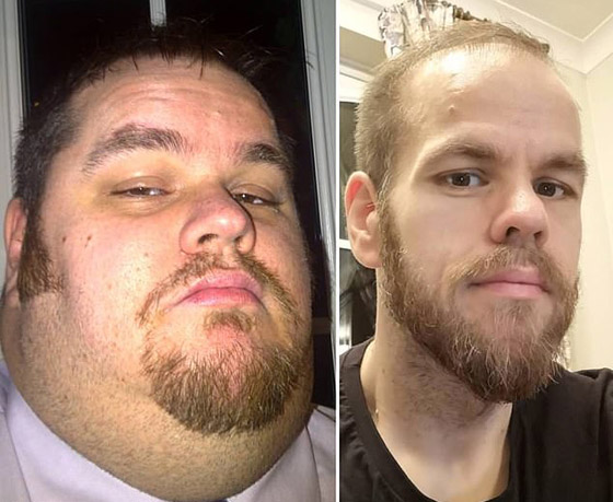 رجل يخسر 215 كيلوغراما ويصبح أكبر خاسر وزن.. إليكم ما تغير! صورة رقم 4