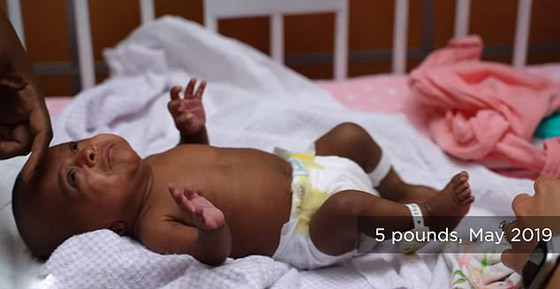 ولادة أصغر رضيعة حجما في العالم.. لن تصدق وزنها! فيديو وصور صورة رقم 2