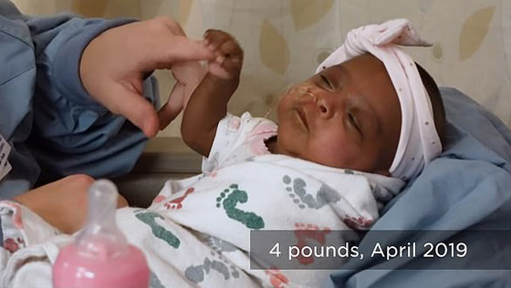 ولادة أصغر رضيعة حجما في العالم.. لن تصدق وزنها! فيديو وصور صورة رقم 5