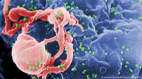 معلومات وحقائق عن الإيدز وفيروس نقص المناعة المكتسب صورة رقم 2