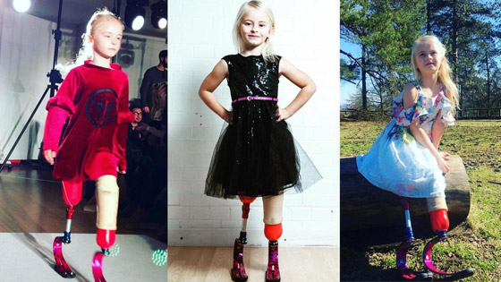 صور: طفلة مبتورة الساقين تشارك في عرض أزياء بأسبوع الموضة صورة رقم 8