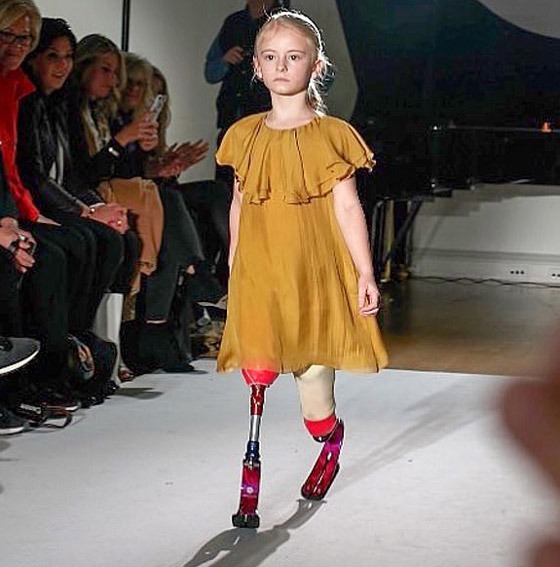 صور: طفلة مبتورة الساقين تشارك في عرض أزياء بأسبوع الموضة صورة رقم 12