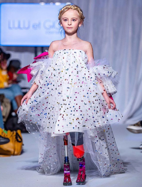 صور: طفلة مبتورة الساقين تشارك في عرض أزياء بأسبوع الموضة صورة رقم 1