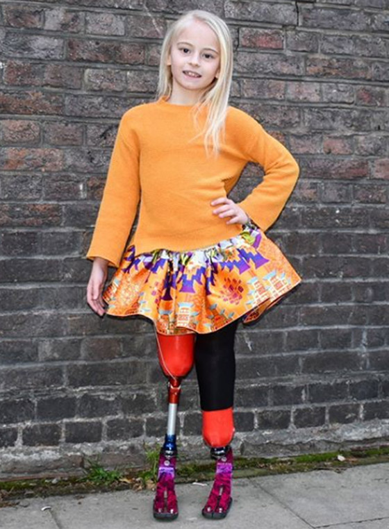 صور: طفلة مبتورة الساقين تشارك في عرض أزياء بأسبوع الموضة صورة رقم 19