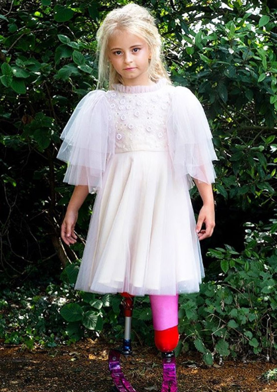 صور: طفلة مبتورة الساقين تشارك في عرض أزياء بأسبوع الموضة صورة رقم 2