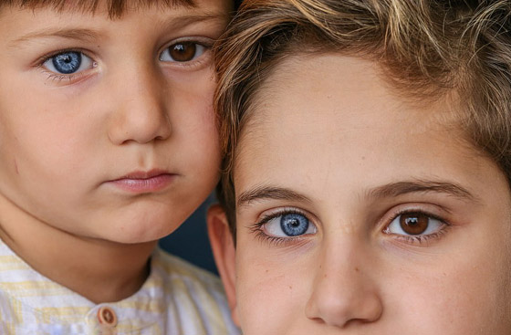 صور: شقيقان لكل منهما عين زرقاء وأخرى بنية والفرق بينهما 7 أعوام صورة رقم 1