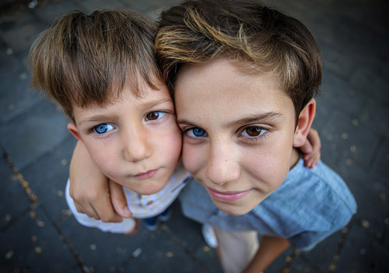 صور: شقيقان لكل منهما عين زرقاء وأخرى بنية والفرق بينهما 7 أعوام صورة رقم 3