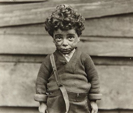 صور تعيسة أنقذت أطفال أميركا في القرن الماضي صورة رقم 4
