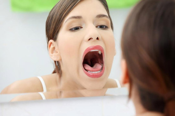 6 طرق طبيعية لعلاج حروق داخل الفم صورة رقم 3