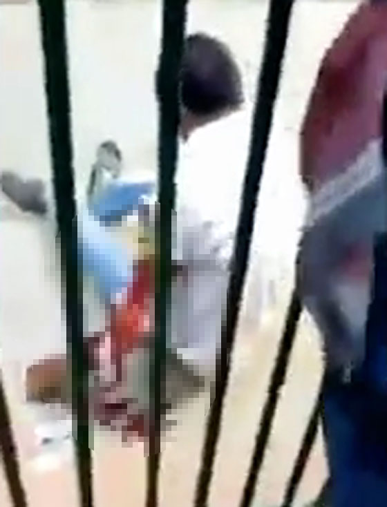 فيديو صادم.. أسد ينهش ذراع حارسه أثناء إطعامه في هجوم مباغت غادر! صورة رقم 6