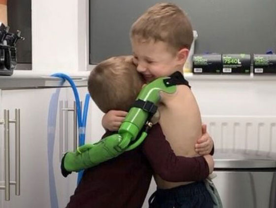 صبي في الخامسة يعانق أخاه للمرة الأولى صورة رقم 2
