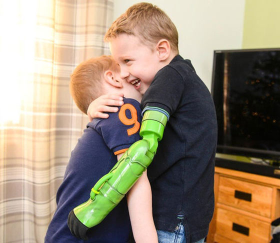 صبي في الخامسة يعانق أخاه للمرة الأولى صورة رقم 20