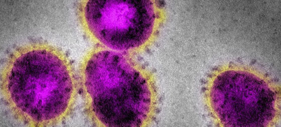 فيروس كورونا: التفشي بلغ مرحلة حرجة وقد يتحول إلى وباء شامل! صورة رقم 48