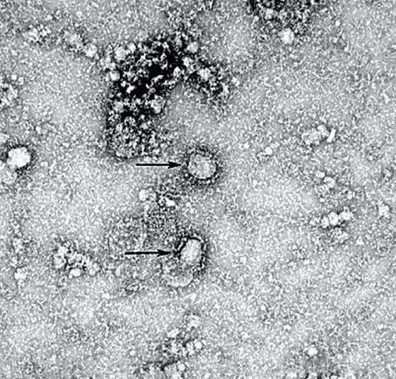 فيروس كورونا: التفشي بلغ مرحلة حرجة وقد يتحول إلى وباء شامل! صورة رقم 40