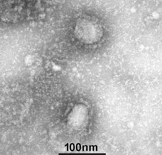 فيروس كورونا: التفشي بلغ مرحلة حرجة وقد يتحول إلى وباء شامل! صورة رقم 41