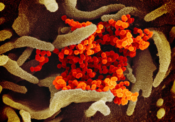 فيروس كورونا: التفشي بلغ مرحلة حرجة وقد يتحول إلى وباء شامل! صورة رقم 8