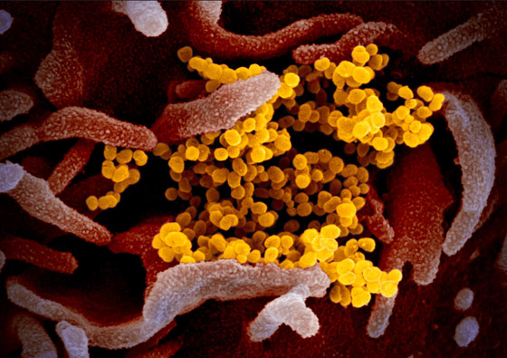 فيروس كورونا: التفشي بلغ مرحلة حرجة وقد يتحول إلى وباء شامل! صورة رقم 3