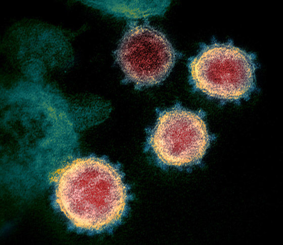 فيروس كورونا: التفشي بلغ مرحلة حرجة وقد يتحول إلى وباء شامل! صورة رقم 24
