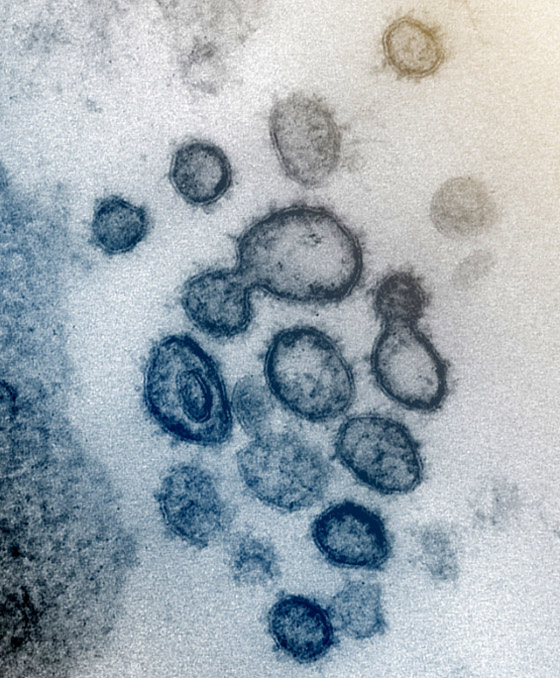 أول صور مجهرية مفصلة لفيروس كورونا القاتل! صورة رقم 7