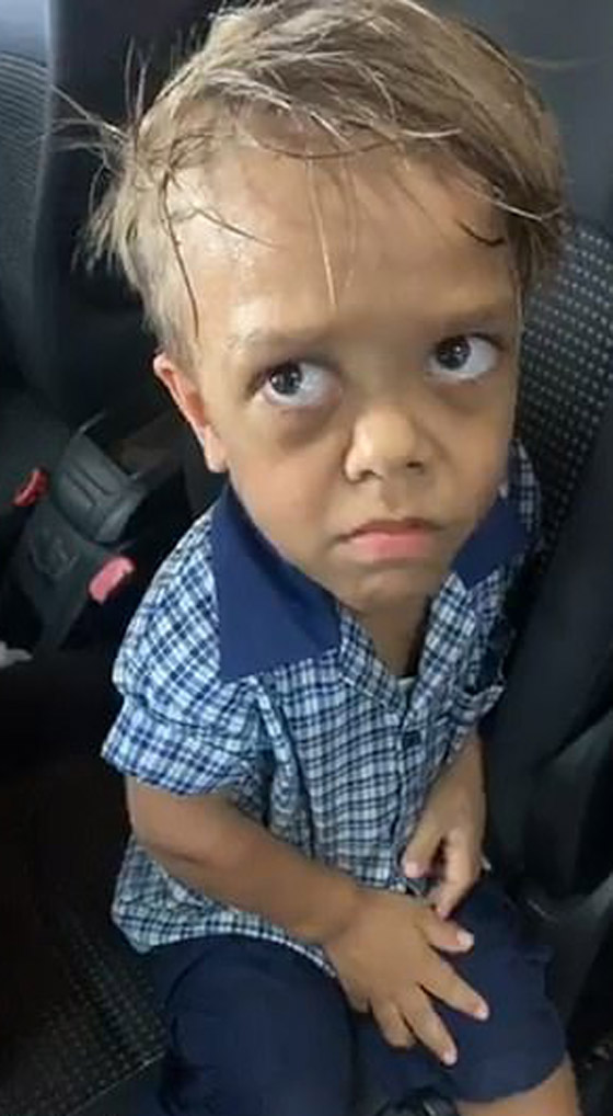 فيديو يدمي القلب: طفل يبكي ويرغب في الانتحار بسبب التنمر على مظهره! صورة رقم 7