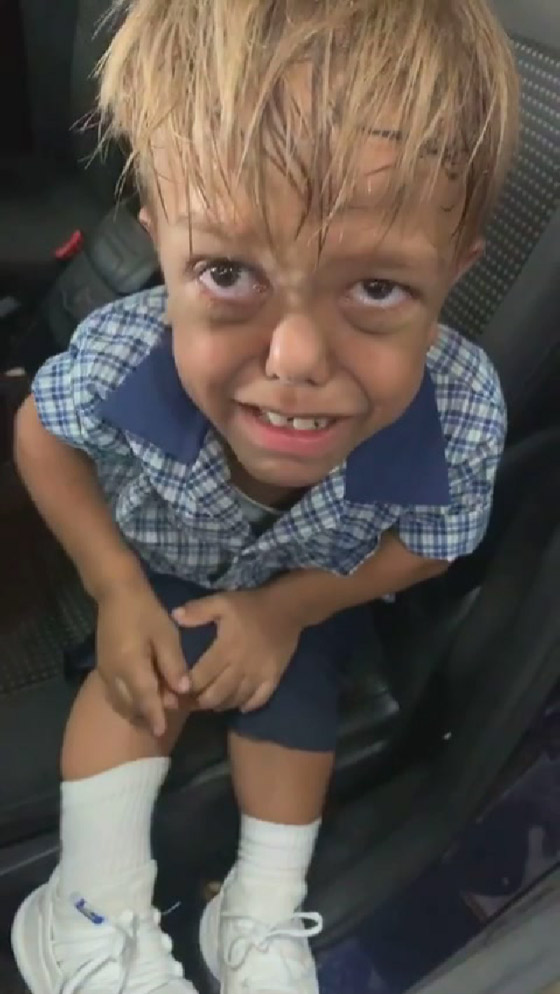 فيديو يدمي القلب: طفل يبكي ويرغب في الانتحار بسبب التنمر على مظهره! صورة رقم 3
