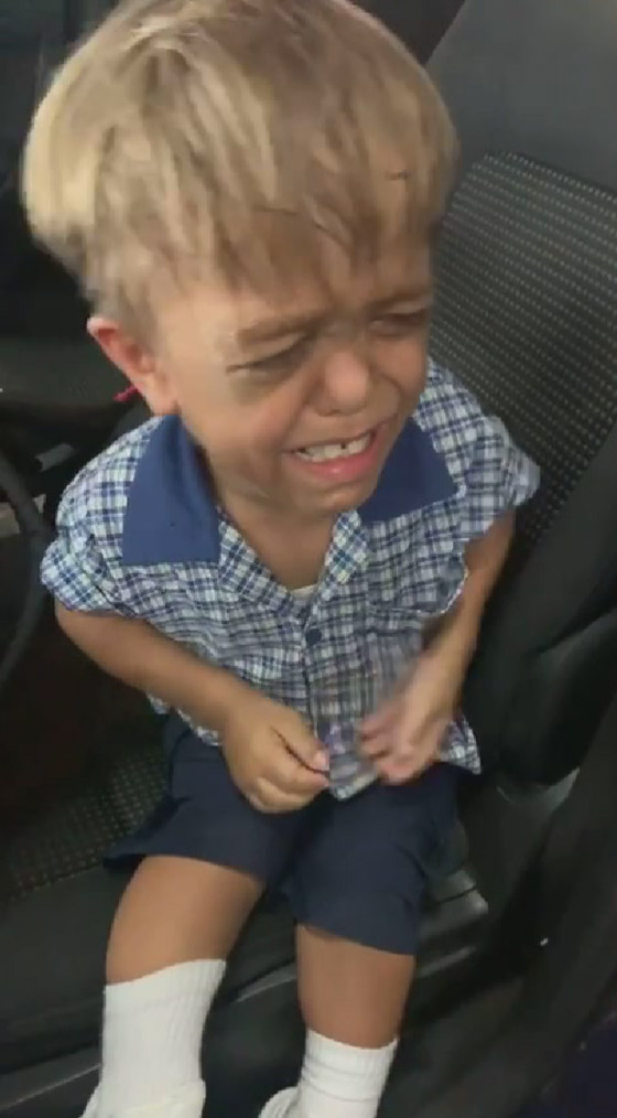 فيديو يدمي القلب: طفل يبكي ويرغب في الانتحار بسبب التنمر على مظهره! صورة رقم 5