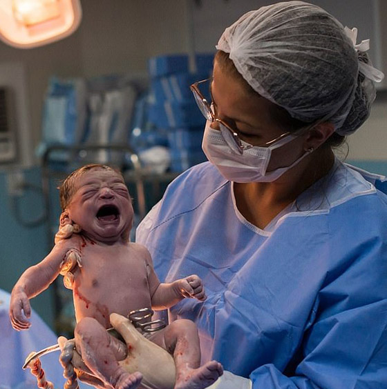 صور طريفة: طفلة تنظر بوجه غاضب إلى طبيبة التوليد في البرازيل صورة رقم 3