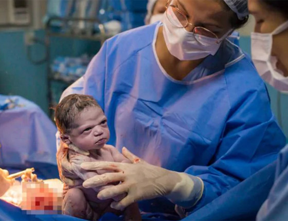 صور طريفة: طفلة تنظر بوجه غاضب إلى طبيبة التوليد في البرازيل صورة رقم 1