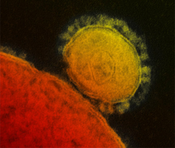 الكويت والبحرين تعلنان اكتشاف إصابات جديدة بفيروس كورونا صورة رقم 2