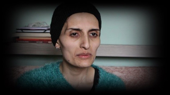 وفاة مغنية تركية..288 يوما بلا طعام احتجاجا على الحكومة صورة رقم 10