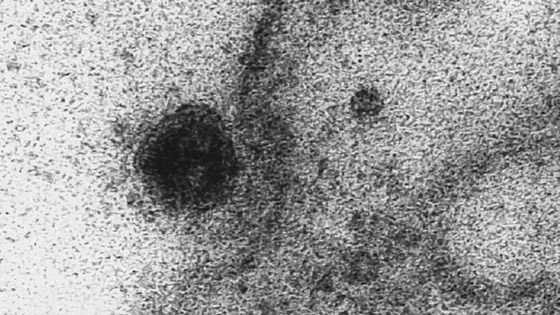 شاهد من مجهر إلكتروني أول رصد للفيروس وهو يمسك بالخلية صورة رقم 1