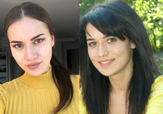 صور صادمة: للنجمات التركيات قبل وبعد عمليات التجميل صورة رقم 1