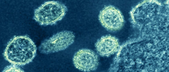 فيروس خنزيري يظهر بالصين ويدق ناقوس الخطر من وباء جديد! صورة رقم 10