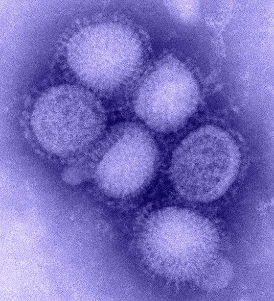 فيروس الخنازير: العالم يترقب إنفلونزا جديدة والصحة العالمية: احذروا! صورة رقم 5