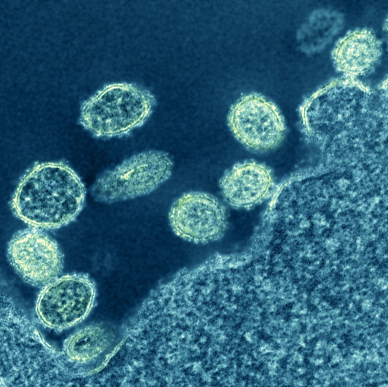 فيروس الخنازير: العالم يترقب إنفلونزا جديدة والصحة العالمية: احذروا! صورة رقم 9