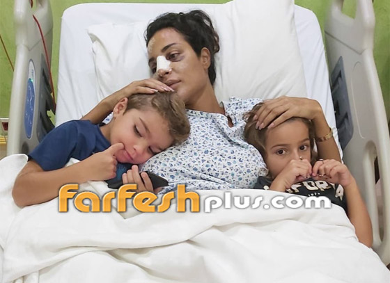 صور: نادين نجيم تحتضن طفليها من داخل المستشفى وتكشف عن جروح وجهها صورة رقم 6