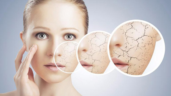 10 نصائح جمالية لحماية بشرتك من الجفاف صورة رقم 4