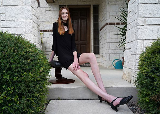 فيديو وصور: فتاة تمتلك أطول ساقين في العالم.. يزيد طولها على مترين! صورة رقم 3