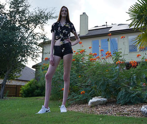 فيديو وصور: فتاة تمتلك أطول ساقين في العالم.. يزيد طولها على مترين! صورة رقم 4