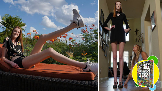 فيديو وصور: فتاة تمتلك أطول ساقين في العالم.. يزيد طولها على مترين! صورة رقم 6