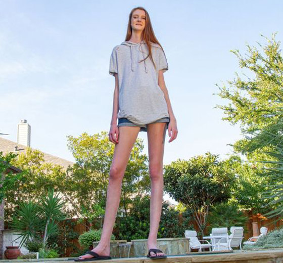 فيديو وصور: فتاة تمتلك أطول ساقين في العالم.. يزيد طولها على مترين! صورة رقم 11