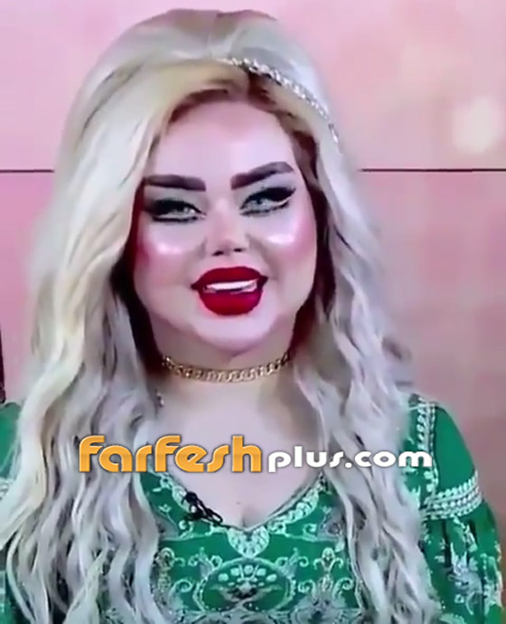 فيديو وصور: عمليات التجميل تحول فنانة عراقية إلى دمية! صورة رقم 2