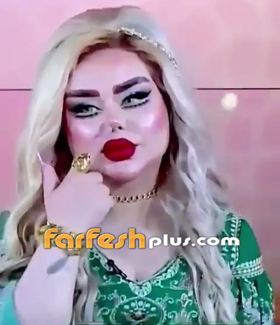 فيديو وصور: عمليات التجميل تحول فنانة عراقية إلى دمية! صورة رقم 3