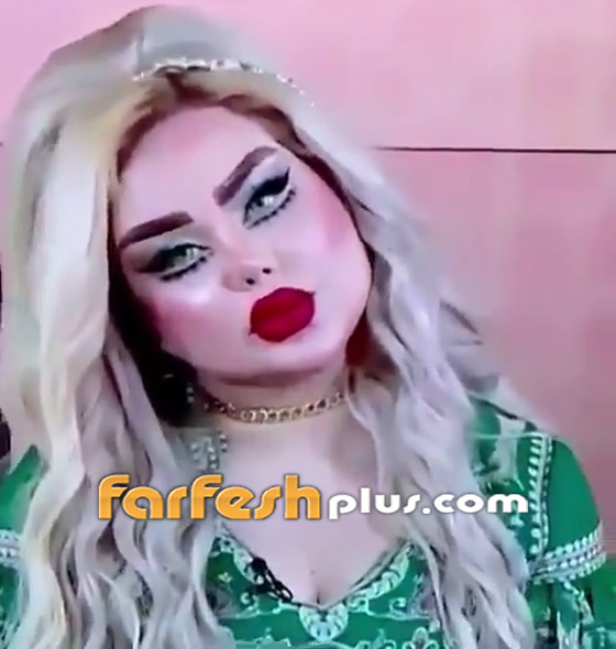 فيديو وصور: عمليات التجميل تحول فنانة عراقية إلى دمية! صورة رقم 4